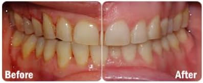 ProBiora Oral-Care Chewable Probiotic Tablets | Probiotic Supplement for Women & Men | Healthier Teeth & Gums | Fresher Breath | Whiter Teeth | 60 Count | Mint