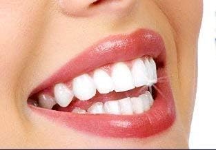 Miracle Brite Smile With Food Grade Hydrogen Peroxide and Essential Oils - Teeth whitening, breath freshening, removing bad breaths & tooth sensitivity.