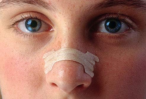 AirPromise Nasal Strip for Reduce Snoring, Better Sleep, Nasal Congestion (Skin Color, 66 * 19mm, 100)