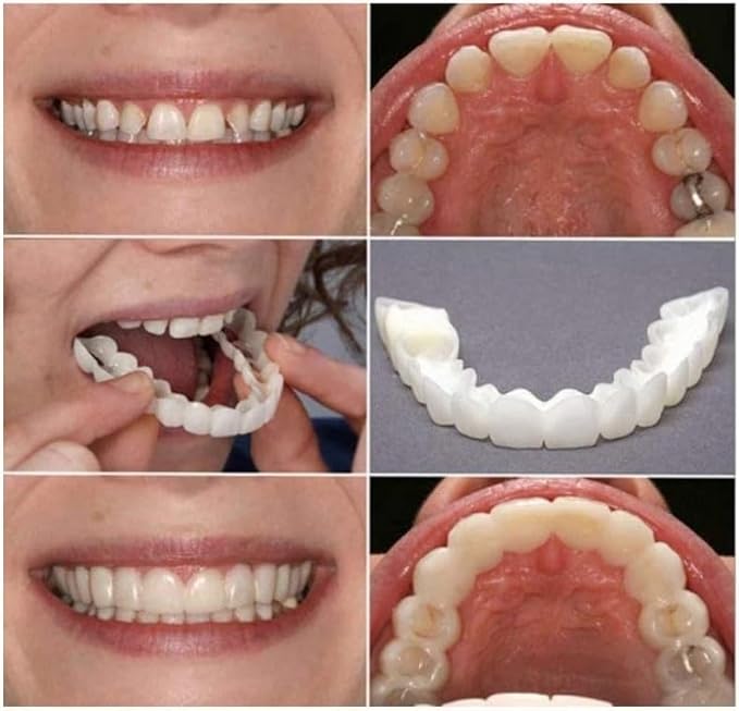 ‌2 Pairs Adjustable Temporary for Men & Women, Natural Comfortable Design to Restore Confident Smile (1)