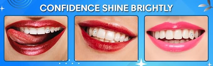 LaserGlow Premium Tooth Gems – 20 Count 2.2mm Forest Green Crystal Dental Jewelry – Shiny Tooth Crystals with Brilliant Reflection, Easy Application & Long-Lasting Hold