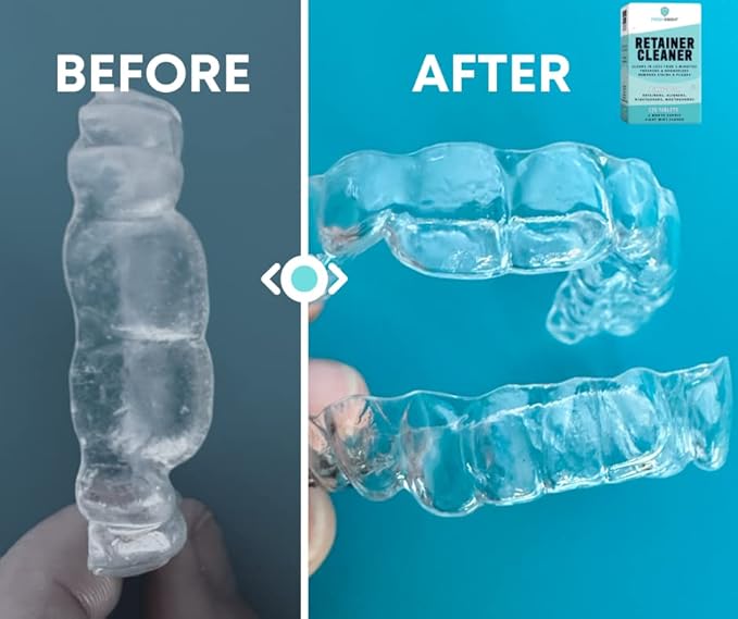 Retainer Cleaner Tablets 120 - Invisalign Cleaner - Denture Cleaner. Efferdent Retainer Cleaner Tablets, Night Guard, Mouth Guards, Aligners & Dental Appliance Cleaner - 4 Month Supply.