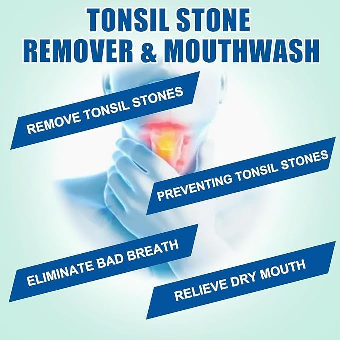 Tonsil Rinse-Tonsil Stone Remover Mouthwash，Natural Mouthwash Soothe Tonsils，Fight Bad Breath，Relieve Dry Mouth-Alcohol-Free，Breath Freshening，Mint Flavor-10 FL OZ