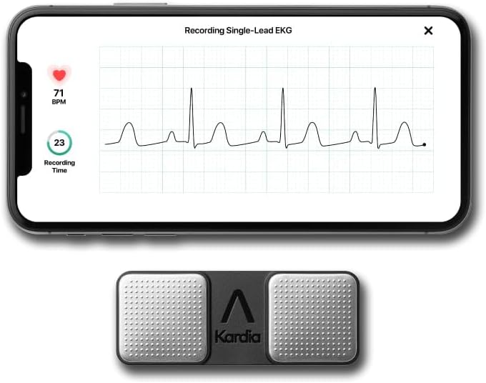 KardiaMobile 1-Lead Personal EKG Monitor – Record at Home – Detects AFib & Irregular Arrhythmias – Easy Results in 30 Seconds – Works w/Most Smartphones