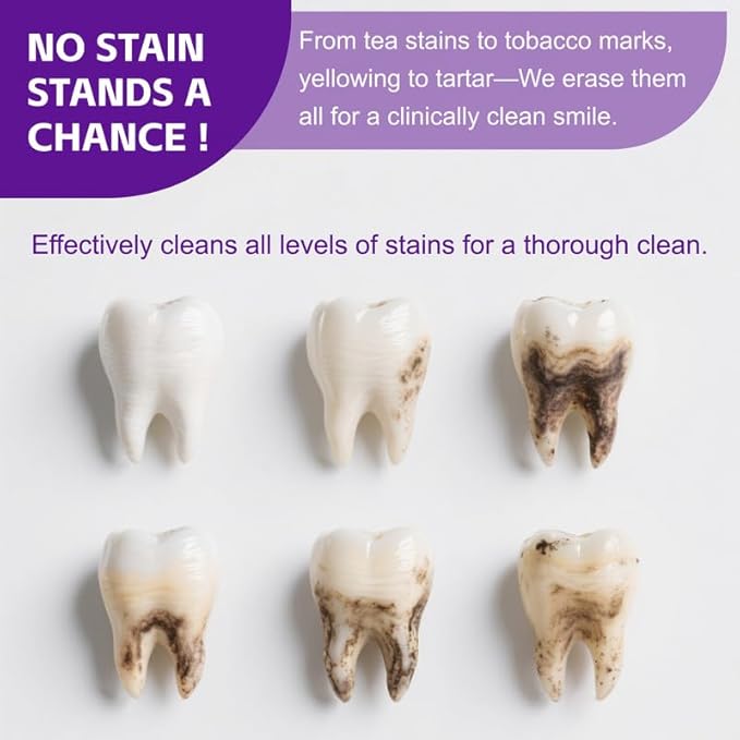 BYMOLlA Whitening Toothpaste Gentle PurpleFormula-Fluoride-Free Enamel Repair -Anti-Plaque Oral Care - Color Corrector for Coffee &Tea Stains -Mint Flavor for Long-Lasting FreshBreath