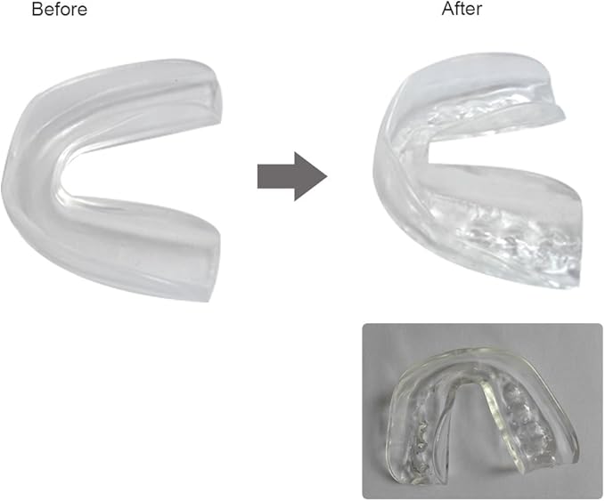 4Set Sports Mouldable Sports Mouth Guards for Adults & Kids,Tooth Protector for Football,Basketball,Boxing,Wrestling,Kickboxing - BPA Free Material (Chroma)