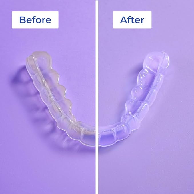 ALIGNER Cleaner Rinse | Concentrated | Clean INVISIALIGN, retainers, dentures, Mouth Guards | 2 Month Supply, (Pack of 1 - Value of 101 fl.oz), Alcohol Free, Minty & Fresh. Made in USA - Pack of 1