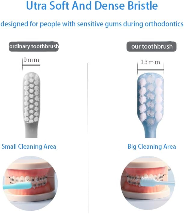 V-Shaped Orthodontic Toothbrush Dental Brush for Braces, for Kids/Teens/Adult, for Sensitive Teeth, for Delicate Gums, Soft Bristles, Toothbrush for Braces, with Tongue Cleaner, Pink, 3pcs