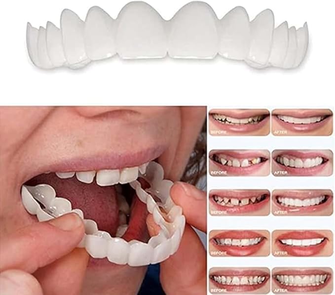 ‌2 Pairs Adjustable Temporary for Men & Women, Natural Comfortable Design to Restore Confident Smile (1)