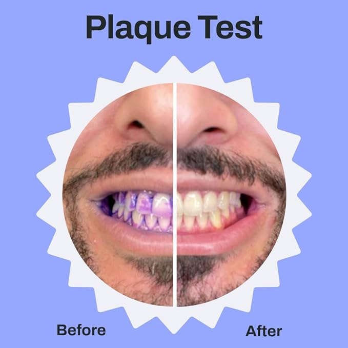 autobrush Sonic Pro Electric Toothbrush – Only ADA Accepted U-Shaped Brush, Clinically Proven Up to 5.1X Better Cleaning, 30-Second Full Mouth 360 Clean, Rechargeable, Waterproof, White, Ages 9-12