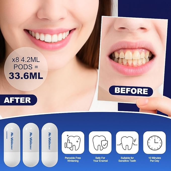 LED Teeth Whitening Kit, Dentists Recommended, Enamel Safe, Professional Pap Tooth Whitener for Sensitive Teeth, Professional 8 Refill Teeth Whitening Gel Pods 33.6ml, Remove Teeth Stains