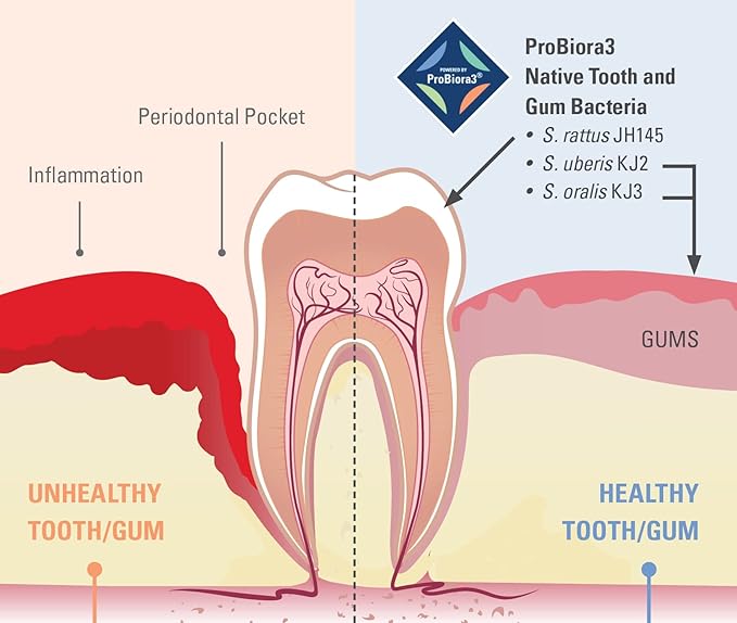 ProBiora Oral-Care Chewable Probiotic Tablets | Probiotic Supplement for Women & Men | Healthier Teeth & Gums | Fresher Breath | Whiter Teeth | 30 Count | Pack of 2 | Orange