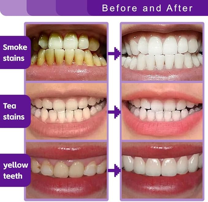 BYMOLlA Whitening Toothpaste Gentle PurpleFormula-Fluoride-Free Enamel Repair -Anti-Plaque Oral Care - Color Corrector for Coffee &Tea Stains -Mint Flavor for Long-Lasting FreshBreath