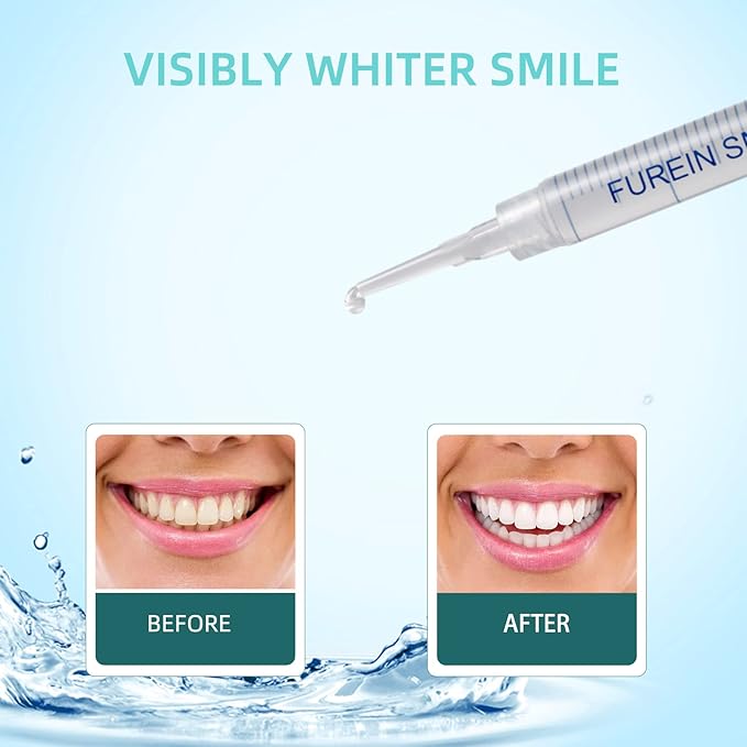 Teeth Whitening Gel Refills 10PCS Tooth Whitener 48+ Treatments -Removes Years of Stains 35% Carbamide Peroxide