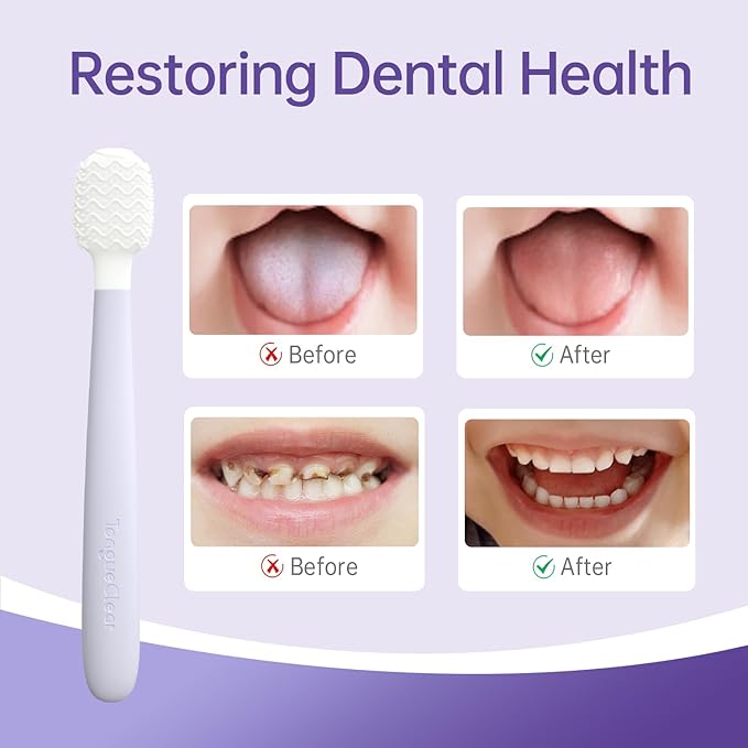 Kids Tongue Scraper, Tongue Cleaner for Infant & Newborn, Baby Oral Cleaner Newborn, Toddler Toothbrush for Tooth Mouth Gum Clean, Infant Toothbrush Oral Cleaning Stick…