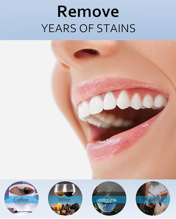 MySmile Teeth Whitening Gel Pen Refill Pack, 3 Non-Sensitive Teeth Whitening Pen, Deluxe Teeth Whitener Dental Grade Tooth Whitening Gel with Carbamide Peroxide for Home, 10 min Fast Result