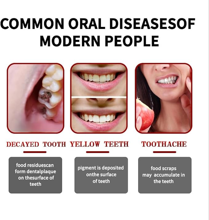 SP10 Probiotic Whitening Toothpaste, Deep Cleaning Care Remove Yellow Tooth Stains, with Probiotic Oral Health Management, Fresh Breath.