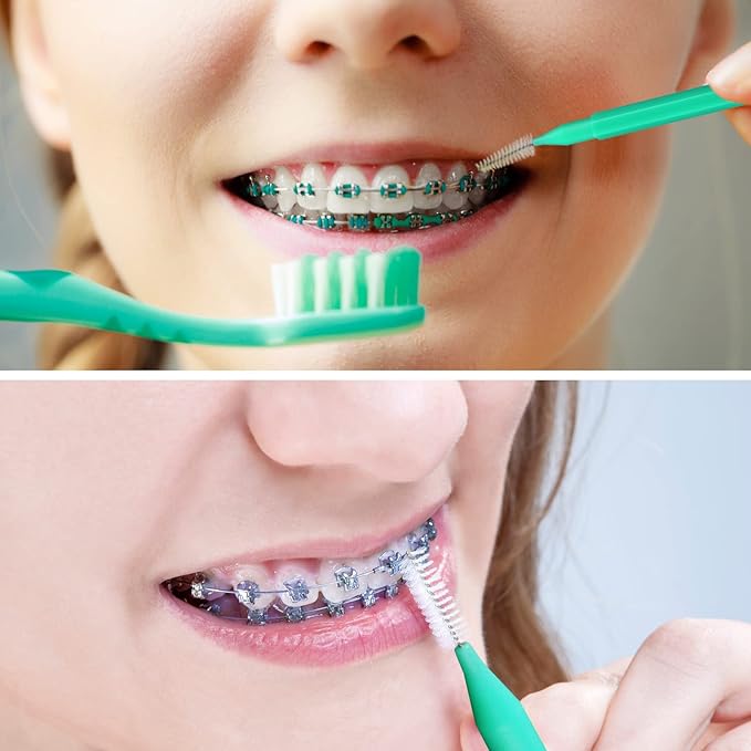 Interdental Brush, 100Pcs Soft Braces Brush Set, 40Pcs Tooth Flossing Head for Oral Hygiene Tooth Cleaning with 60pcs Disposable Braces Flossers Tooth Cleaning Tool (Stylish Colors,Multiple Sizes)