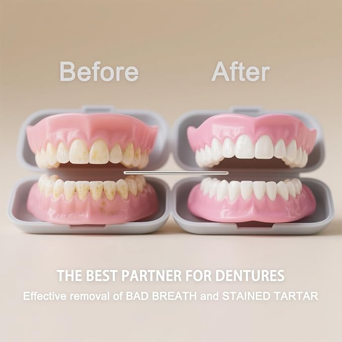 Denture & Aligner Cleaning Tablets, 30 Count, 0.17 oz, For Dentures, Retainers and Night Guards