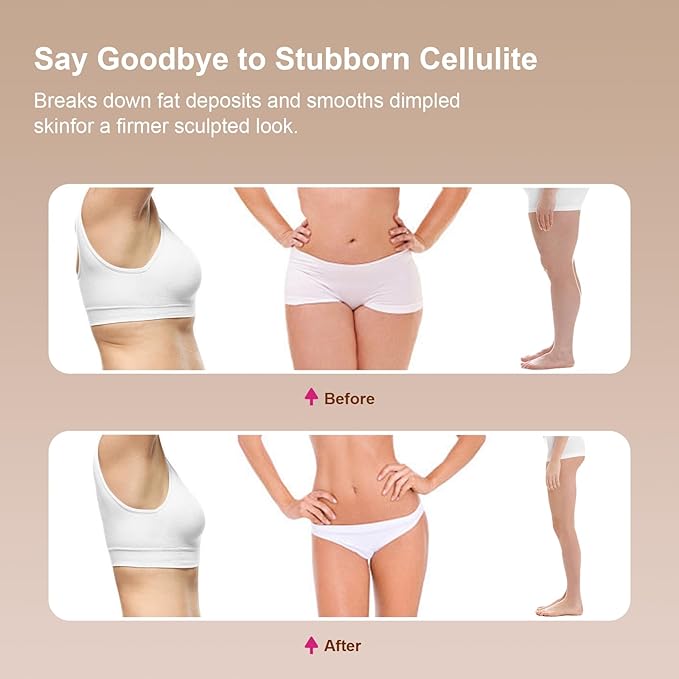 Lymphatic Drainage Massager for Legs, Arms & Belly – Anti Cellulite & Stretch Marks Reduction Tool with Microcurrent, Heat, Vibration & Light Therapy – Portable Body Sculpting Machine for Home Use