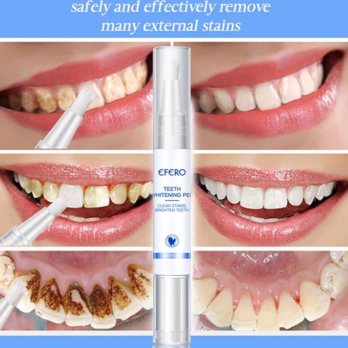 Teeth Whitening Gel Pen Essence for Tooth Instant Polish White Style1