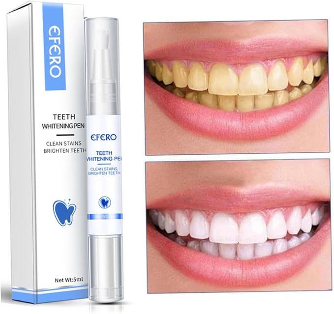 Teeth Whitening Gel Pen Essence for Tooth Instant Polish White Style1