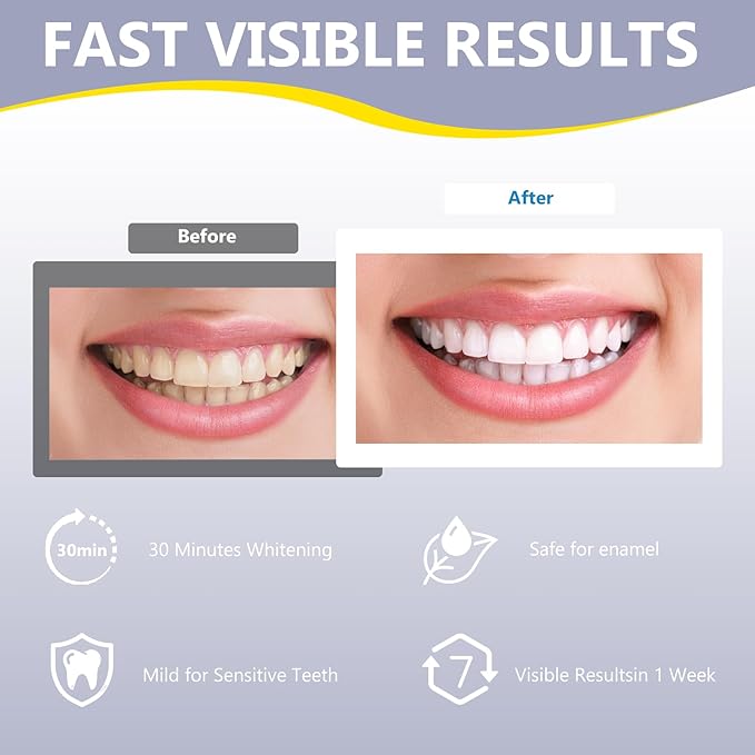 Teeth Whitening Strips for Sensitive, Whitener Safe Whitestrip, Deep Stains Removal Tooth Whitening, Enamel Safe Non-Slip Dry Strip Technology for Whiter Teeth