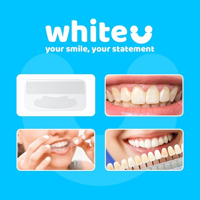 WhiteU Teeth Whitening Strips – 14 Strips – Peroxide-Free, Enamel-Safe, Sensitivity-Free – Advanced Whitening with Pap+ – Professional Dental Care for Whiter Teeth, Tartar Control – Mint Flavored