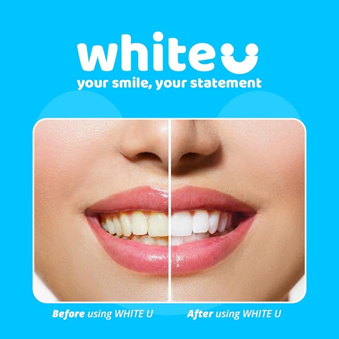 WhiteU Teeth Whitening Strips – 14 Strips – Peroxide-Free, Enamel-Safe, Sensitivity-Free – Advanced Whitening with Pap+ – Professional Dental Care for Whiter Teeth, Tartar Control – Mint Flavored