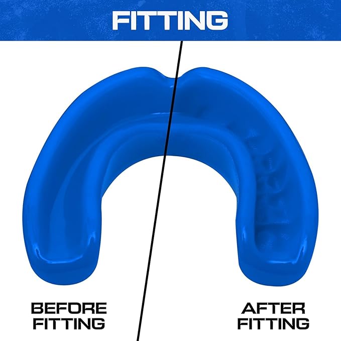 Sports Mouth Guard for Kids,Youth,Boys,Girls,Child Teen Mouthguard with Case (BPA Free) for Boxing, Martial Arts,MMA Karate,Lacrosse,Football,Soccer and All Contact Sports (Royal Blue)