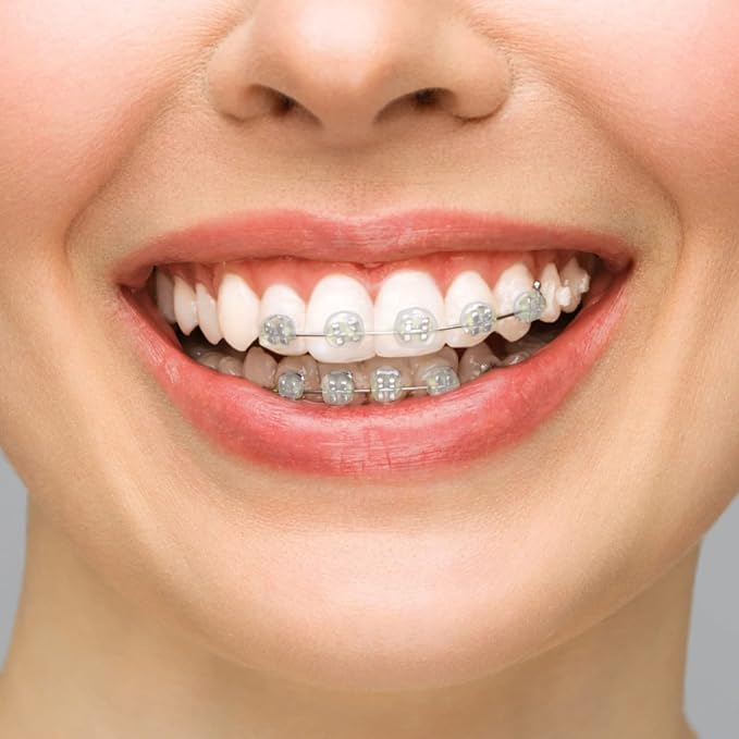 BVN Braces Wax Dental Wax: 20 Boxes Orthodontic Wax Strips, Braces Wax for Teeth, Ortho Wax for Braces, Tooth Wax, Mouth Wax, Oral Wax for Braces, Relief Wax for Braces Wearer Aligners Patients