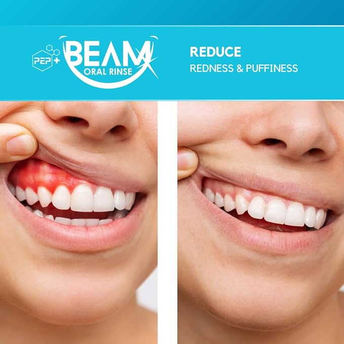 PEP+ BEAM Alcohol-Free Fluoride-Free Mouthwash with Peptides and Xylitol, Oral Rinse for Enamel Strength, Gum Support, Fresh Breath, Microbiome Balance, Dentist Inspired, Travel Size 3.4oz (2 Pack)