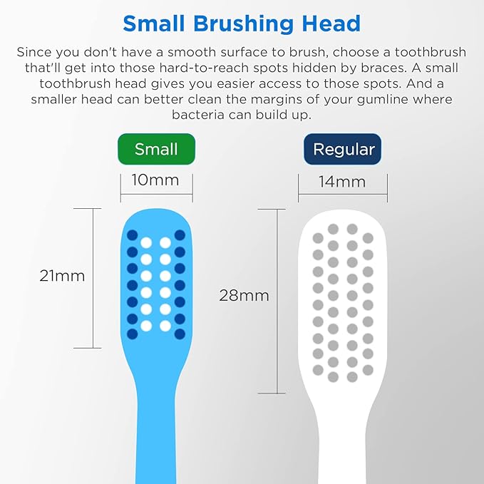 V-Shaped Orthodontic Toothbrush for Braces, Soft Bristles, 6 Count