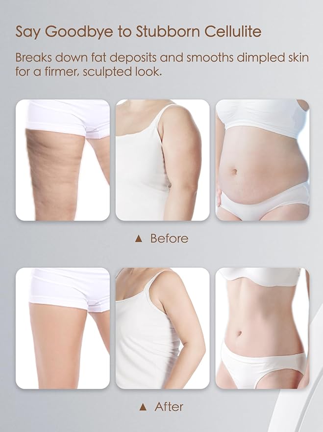 Lymphatic Drainage Massager & Anti Cellulite Massage Tool, Helps Reduce Stretch Marks & Cellulite, for Legs, Arms & Belly, Body Sculpting Machine with Microcurrent, Light, Heat & Vibration,Red