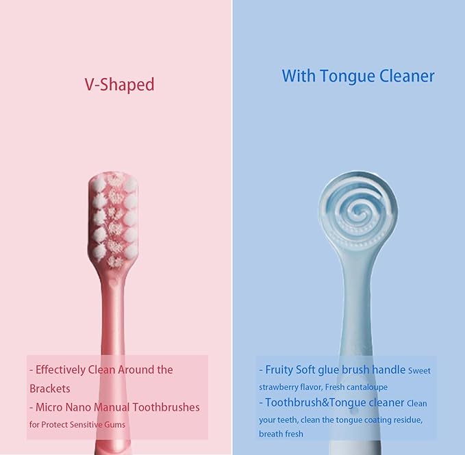 V-Shaped Orthodontic Toothbrush Dental Brush for Braces, for Kids/Teens/Adult, for Sensitive Teeth, for Delicate Gums, Soft Bristles, Toothbrush for Braces, with Tongue Cleaner, Blue, 3pcs