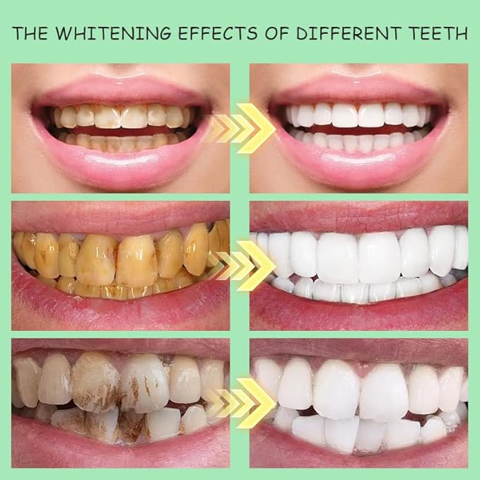 White Spearmint Oil Pulling Rinse, Cold-Pressed Coconut Mouthwash for Teeth Whitening, Powerful Organic Peppermint Oil Maintain Gum Health & Freshness Breath, Mint Mouthwash (8 fl oz)