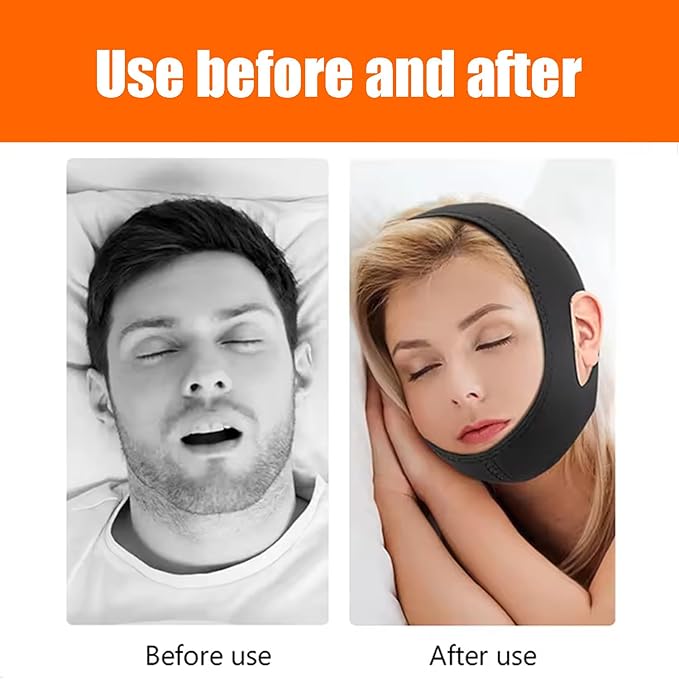 Chin Strap for Sleeping User, Anti Snoring Chin Strap to Keep Mouth Closed, Airflow Jaw Strap for Sleep Apnea, Snoring Cpap Chin Straps for Men Women with Eyeshade, Nasal Strips and Earplugs