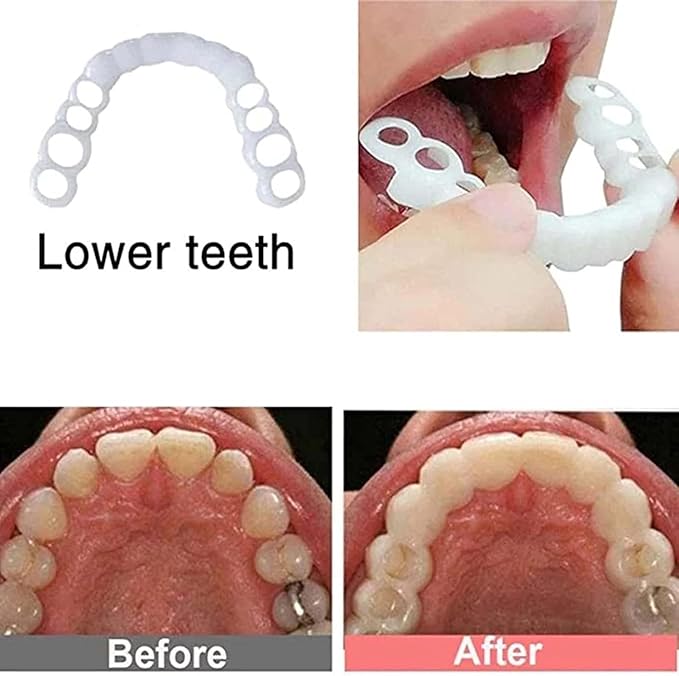 ‌2 Pairs Adjustable Temporary for Men & Women, Natural Comfortable Design to Restore Confident Smile (1)