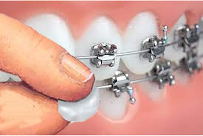 Genuine Orthowax™ - Precut Orthodontic Dental Waxes (Pk of 18) - Stick Better - Orthodontic Wax by Orthomechanics - Aloe Vera and Vitamin E