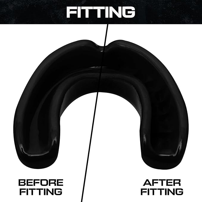 Sports Mouth Guard for Kids,Youth,Boys,Girls,Child Teen Mouthguard with Case (BPA Free) for Boxing, Martial Arts,MMA Karate,Lacrosse,Football,Soccer and All Contact Sports (Black)