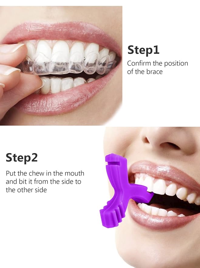 Chewies for Invisalign Aligner, DLENP 2 Pcs Y-Shaped Orthodontic Munchies Chewies for Invisible Aligner Seater(Purple-2Pcs)