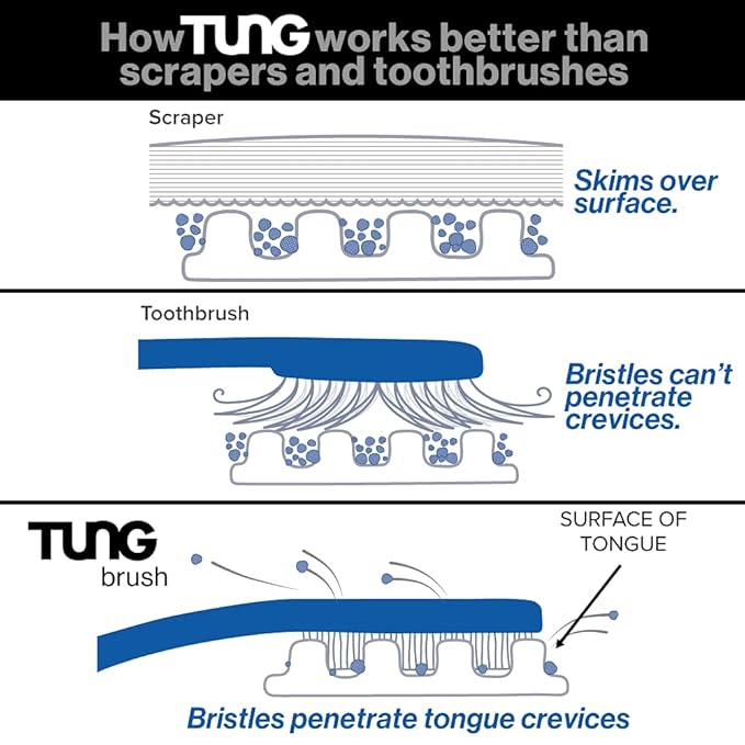 Tung Tongue Cleaning Kit, Tung Brush and Gel, Bad Breath Odor Eliminator, Halitosis Defense, USA Made (Set of 2)