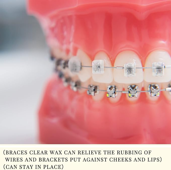 Sinmoe 40 Pack Dental Wax for Braces Orthodontic Wax for Teeth Oral Appliances with Colorful Storage Case and Small Plastic Cutter Repair Kit for Dental Care Wearer Braces Brackets