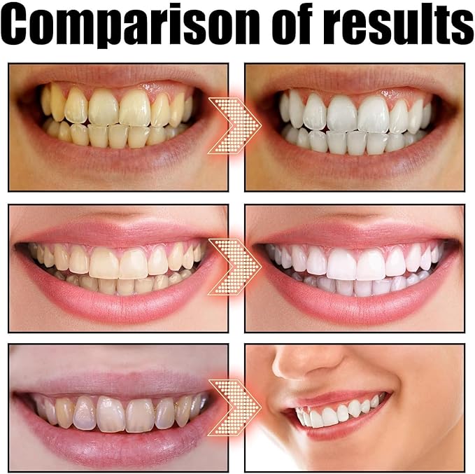 Spearmint Oil Pulling Rinse, Cold-Pressed Coconut Mouthwash for Teeth Whitening, Peppermint Oil for Teeth and Gums (1)