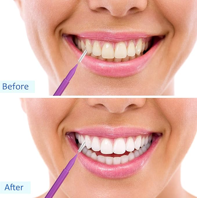 Patelai 50 Pieces Interdental Brush for Cleaner Braces Brush Toothpick Dental Tooth Flossing Head Oral Dental Hygiene Flosser Toothpick Cleaners Tooth Cleaning Tool(Red, Purple, Yellow, Gray, White)