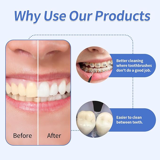 Interdental Brush, 100Pcs Soft Braces Brush Set, 40Pcs Tooth Flossing Head for Oral Hygiene Tooth Cleaning with 60pcs Disposable Braces Flossers Tooth Cleaning Tool (Stylish Colors,Multiple Sizes)