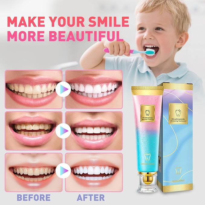 Niacinamide Whitening Toothpaste, Nicotinamide White Toothpaste, Clean The Mouth, Fresh Breath, Remove Tooth Stains, Teeth Whitening Toothpastes