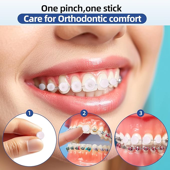 RAZOKO Orthodontic Wax for Braces Wax Dots 90 Individual Hygienic Packaging Dental Wax Strawberry