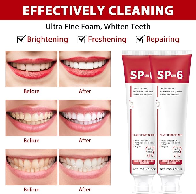 2Pcs Sp-6 Ultra Whitening, Sp-6 Probiotic Whitening Toothpaste, Deep Cleaning Care Toothpaste 120g