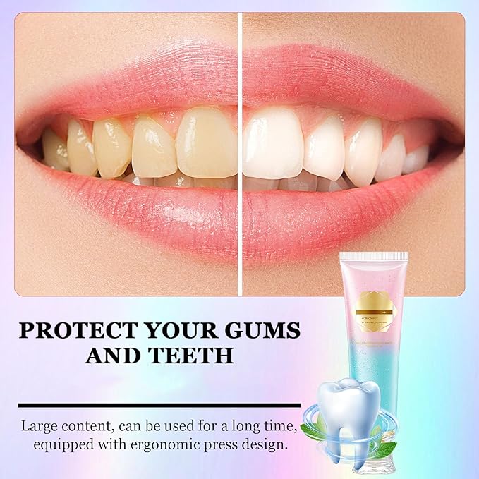 2Pcs Acssart Radiant Whitening Toothpaste, Niacinamide Intensive White Toothpastes, Nicotinamide White Toothpastes, Deep Cleaning Care